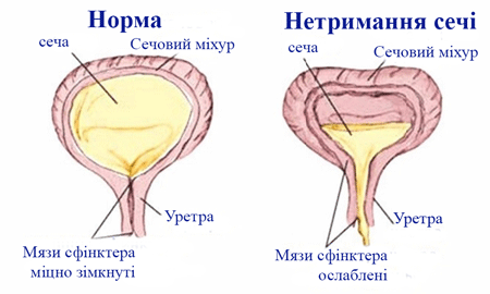 Vpravi Pri Opushenni Matki